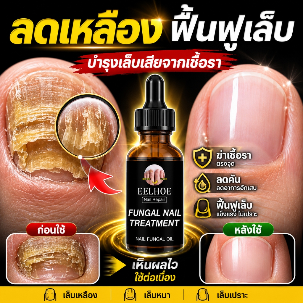 น้ำยาดูแลเล็บเหลือง ฟื้นฟูเล็บเสียจากเชื้อรา ใช้งานง่าย 30ml