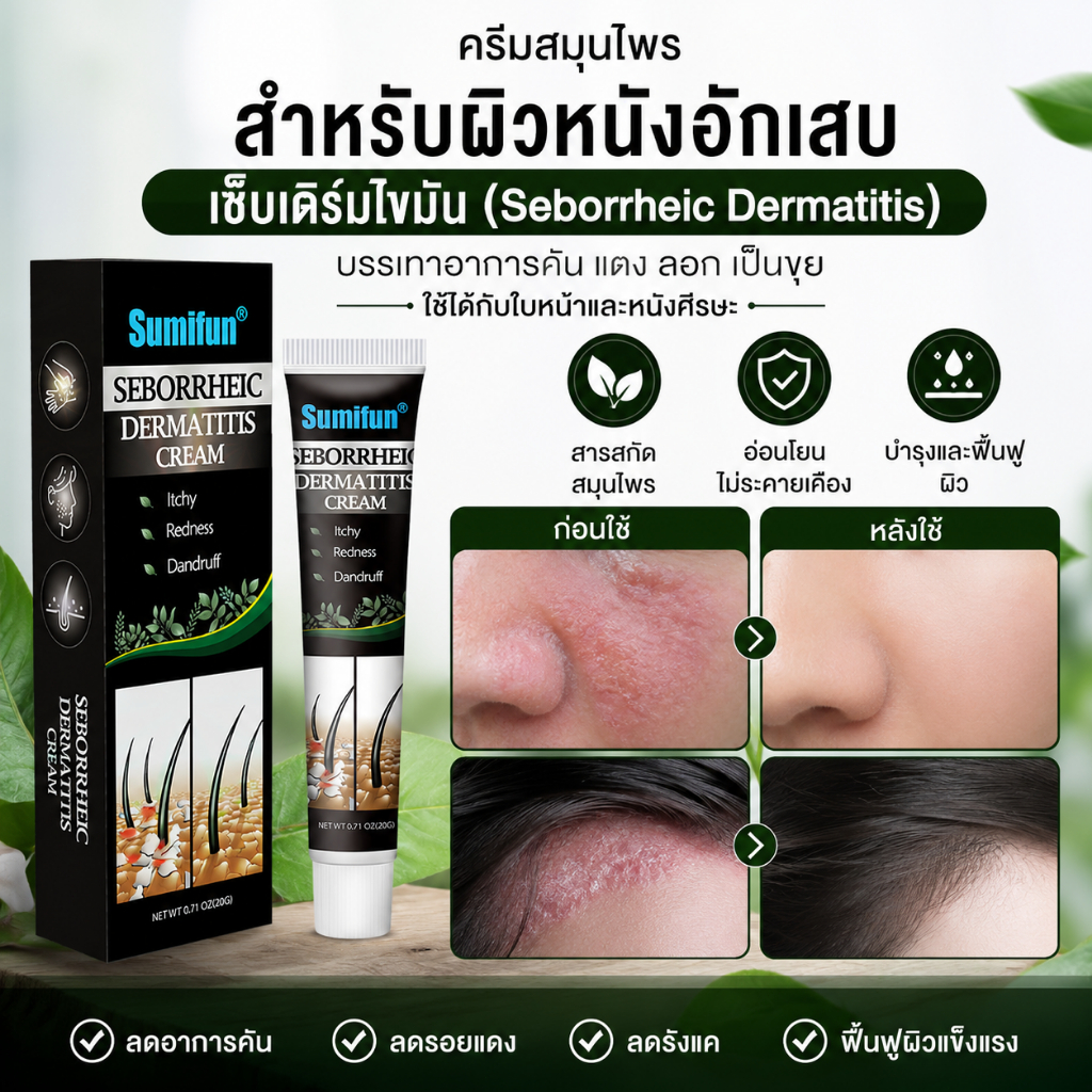 ครีมบำรุงผิว Seborrheic Dermatitis สูตรสมุนไพร ดูแลผิวแห้งลอก ผิวมันง่าย ลดความไม่สบายผิว บำรุงหนังศีรษะและผิวหน้า อ่อนโ