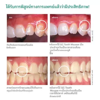 🔥 GC Tooth Mousse 40g อย.ไทย แท้100% ( ทูธ มูส กลิ่นสตอเบอรี่ ) สกัดมาจากโปรตีนในน้ำนมวัว