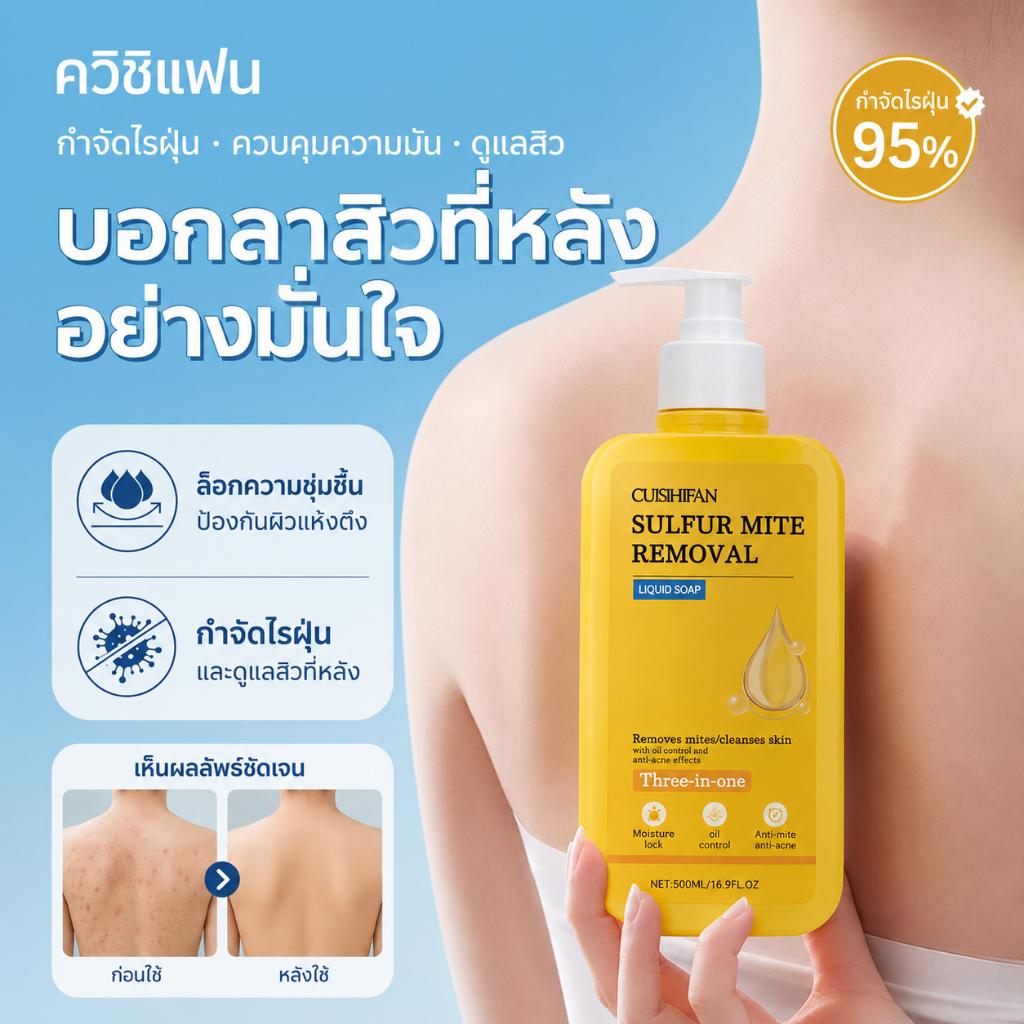 【ซื้อ1 แถม1】สบู่อาบน้ำกำมะถัน 300ml ขจัดไร คุมมัน ให้ผิวชุ่มชื้นกระจ่างใส  กำจัดไร ลดผื่นคัน แก้ขนคุด เรื้อรัง body wash