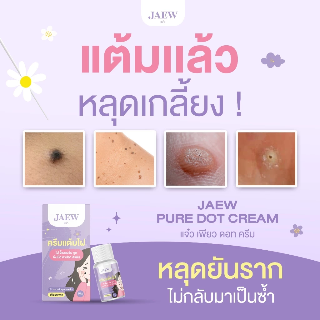 ครีมแต้มไฝแจ๋ว ขี้แมลงวัน ติ่งเนื้อ หูด ตาปลา แก้ปัญหา สิวหิน ครีมแต้มไฝแจ๋วไฝ หูด จี้ไฝ แต้มไฝ แต้มหูด
