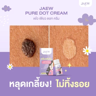 ครีมแต้มไฝแจ๋ว ขี้แมลงวัน ติ่งเนื้อ หูด ตาปลา แก้ปัญหา สิวหิน ครีมแต้มไฝแจ๋วไฝ หูด จี้ไฝ แต้มไฝ แต้มหูด
