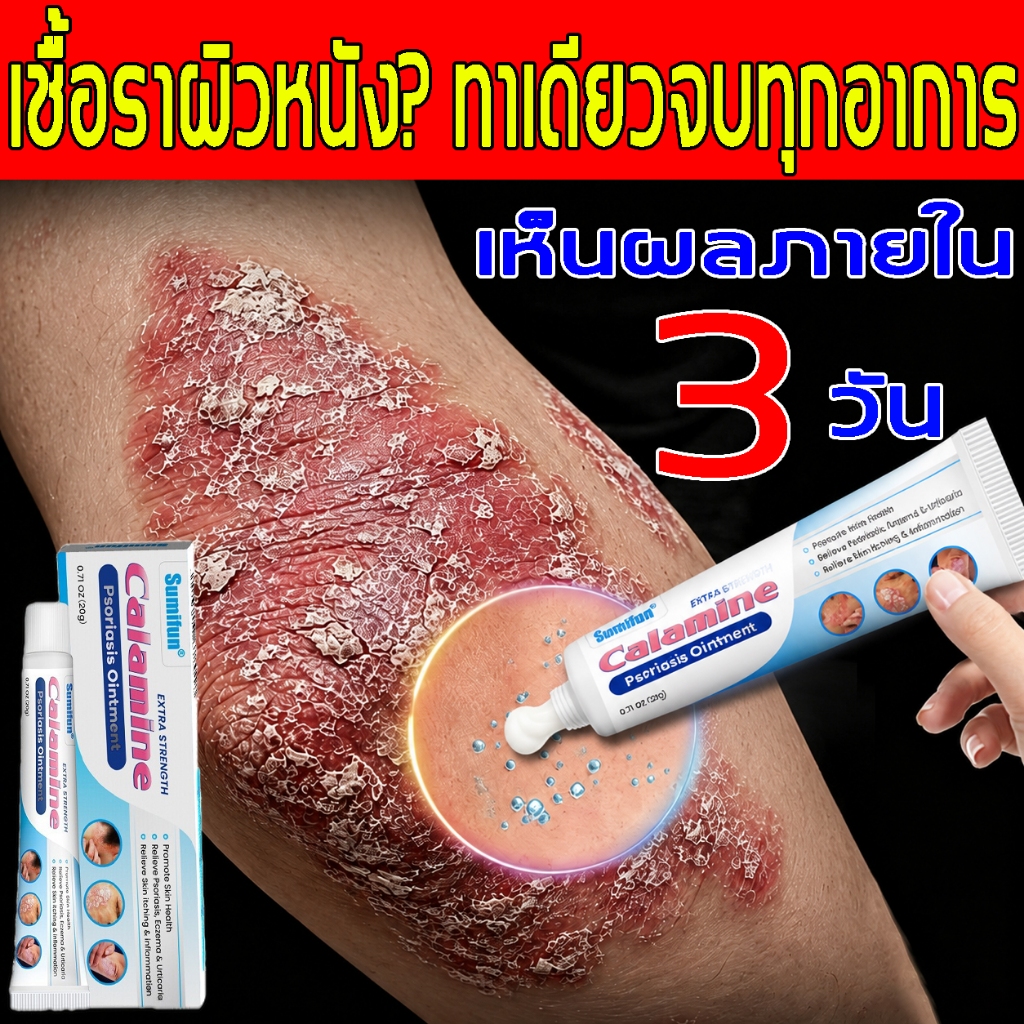 ครีมบำรุงผิว สำหรับผิวคัน ระคายเคือง ผื่น แพ้ ผิวอักเสบ กลาก ผิวบอบบาง อ่อนโยน ส่วนผสมจากธรรมชาติ บำรุงและปกป้องผิว
