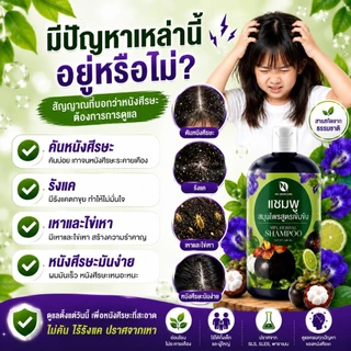 แชมพูเหาขวดใหญ่ แชมพูกำจัดเหา ยาฆ่าเหา รังแค เชื้อราบนหนังศรีษะ คันหัว แชมพูเหาเด็กผู้ใหญ่