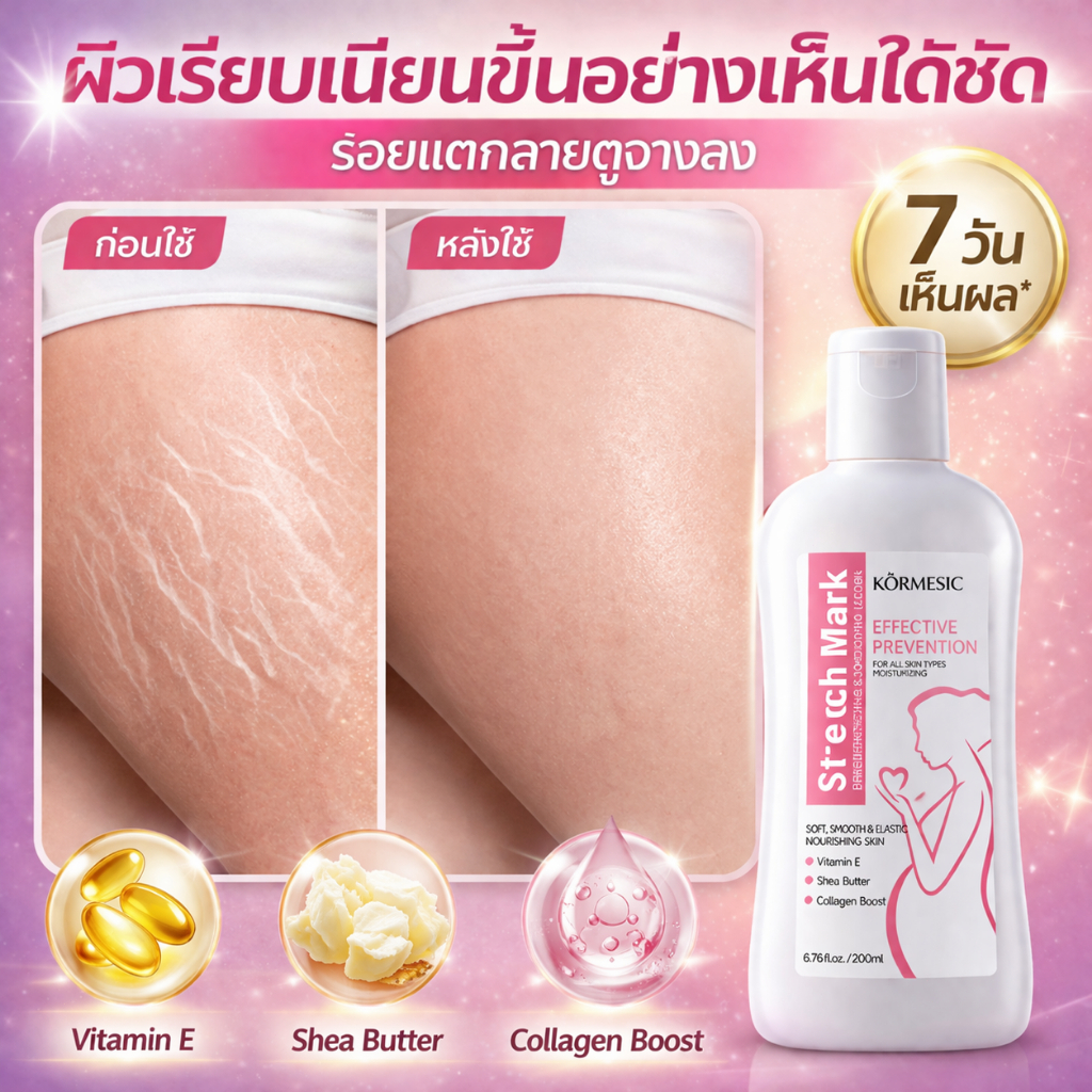 ครีมรอยแตกลาย ลดรอยแตกลาย ครีมทาขาแตกลาย ครีมลดรอยแตกลาย ทา7วันหาย ครีมทาหน้าท้อง ครีมลดผิวแตก ครีมทาท้องลาย