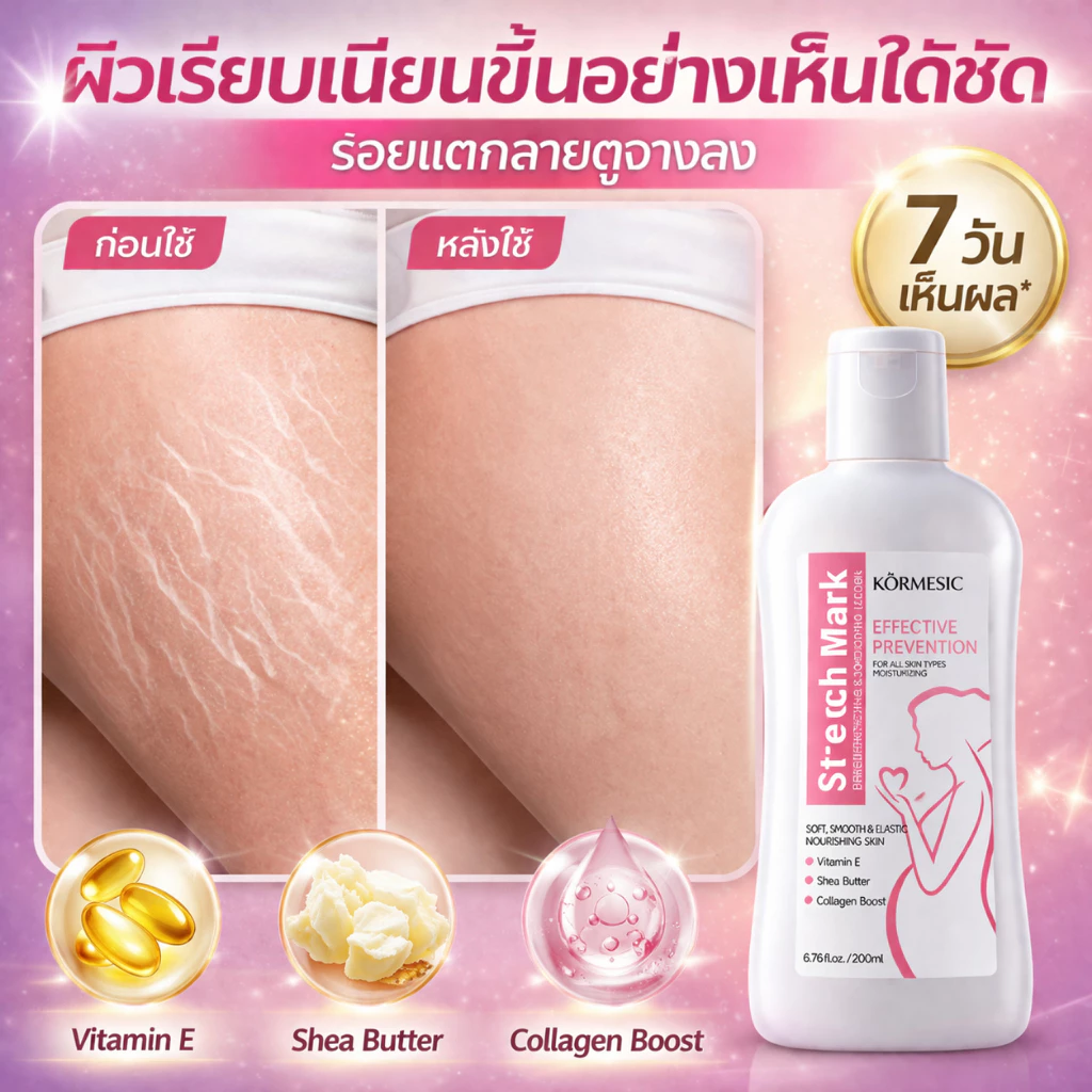 ครีมรอยแตกลาย ลดรอยแตกลาย ครีมทาขาแตกลาย ครีมลดรอยแตกลาย ทา7วันหาย ครีมทาหน้าท้อง ครีมลดผิวแตก ครีมทาท้องลาย