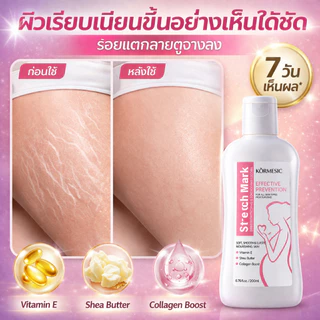 ครีมรอยแตกลาย ลดรอยแตกลาย ครีมทาขาแตกลาย ครีมลดรอยแตกลาย ทา7วันหาย ครีมทาหน้าท้อง ครีมลดผิวแตก ครีมทาท้องลาย