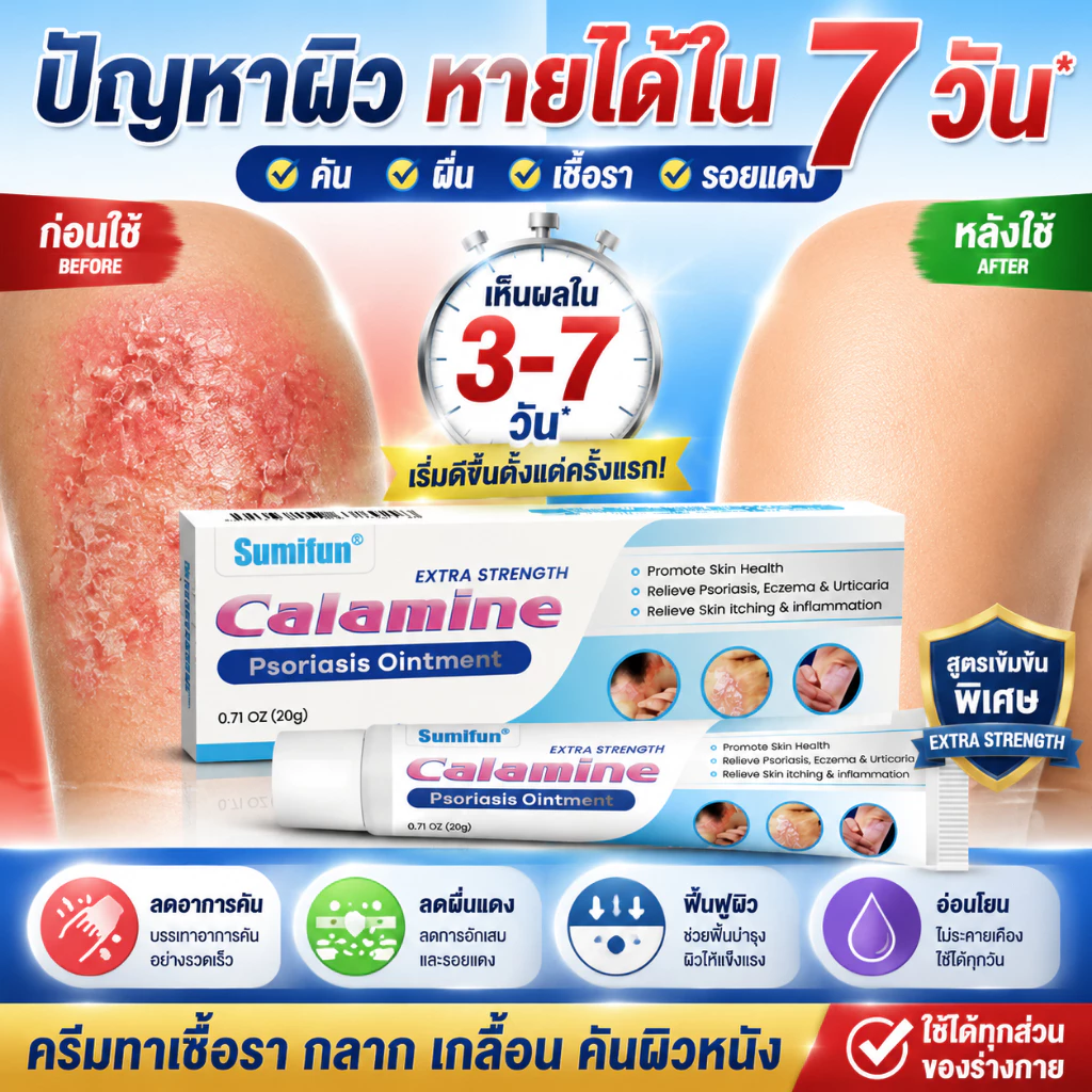 ครีมคาลาไมน์ ช่วยลดคัน ลดผื่น ดูแลผิวระคายเคือง