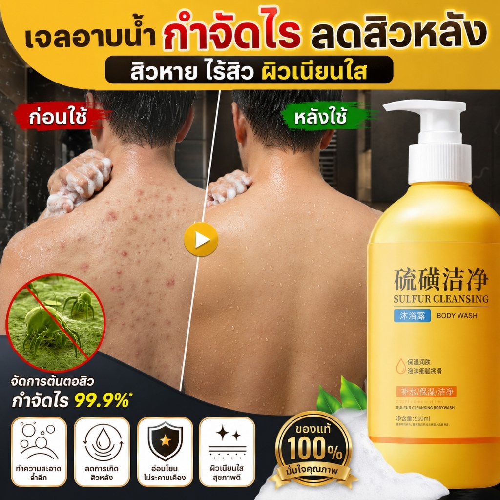 ครีมอาบน้ำกำมะถัน Body Wash 3ใน1 ทำความสะอาดลึก กำจัดไรต่างๆ ปรับผิวใส
