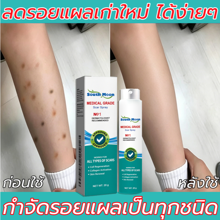 【100%ของแท้】South Moon สเปรย์ลบรอยแผลเป็น 20g เจลลดรอยแผลเป็น ครีมทาแผลเป็น แผลไฟไหม้ รอยสิว รอยแตกลาย รอยแผลเป็นเป็นต้น