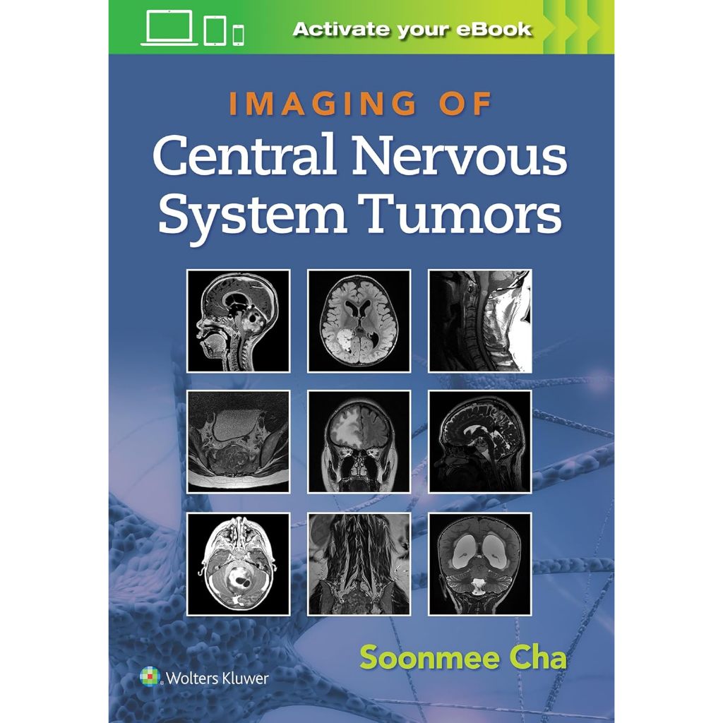 หนังสือ Imaging of Central Nervous System Tumors ed 1/2022
