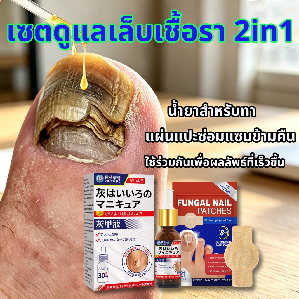 เซตดูแลเล็บเชื้อรา 2in1 น้ำยาทาเล็บ+แผ่นแปะซ่อมกลางคืน แก้เล็บเหลือง หนา แตก เป็นชั้น ใช้คู่กันเห็นผลเร็ว