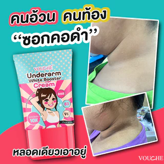 ส่งไว ครีมรักแร้ขาว ครีมทารักแร้ ใช้แทนโรลออน ระงับกลิ่นทั้งวัน กลิ่นตัวแรงเอาอยู่