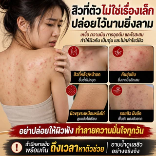 เจลอาบน้ำกำมะถัน ช่วยกำจัดไรขนาดเล็ก ลดสิวหลัง แผลอักเสบรูขุมขน ทำความสะอาดล้ำลึก เหมาะสำหรับผิวแพ้ง่าย ขนาด 500 มล