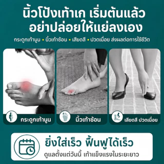 Klenik แยกนิ้วเท้า ซิลิโคน แยกนิ้วเท้า ตาปลา แยก ตาปลา Hallux Valgus แก้ไข นิ้วหัวแม่มือ แก้ไข ที่หนีบ ดูแลเท้า