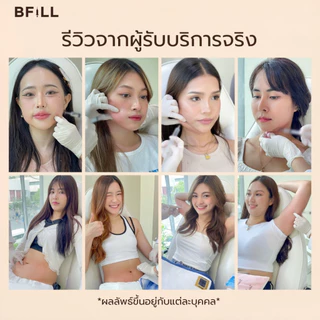 BFiLL โปรแกรม Fat ฉีดแฟต ลดไขมัน ลดแก้ม ลดเหนียง ปรับรูปหน้า หน้าเรียว กรอบหน้าชัด ลดสัดส่วน ลดไขมันเฉพาะจุด ผิวกระชับ