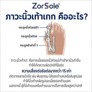เจลแยกนิ้วเท้า 5 ช่อง จัดเรียงนิ้วเท้า ลดนิ้วเบียด orthopedic spacers