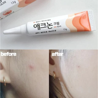 (🌼แท้ / พร้อมส่ง🌼) DONG-A PHARM Acnon Cream 13 g #แต้มสิว [ กล่องมีโลโก้บวก ]