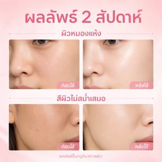 PAZIUM ครีม ครีมนีอาซินาไมด์ Cream ลดรอยด่าง รอยสิว ฝ้า ชุ่มชื้นล้ำลึก ไม่เหนียวเหนอะ 30G