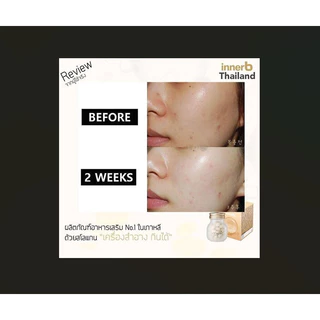 🔥Saleลดล้างสต็อก🔥 InnerB Aqua Rich อินเนอร์บี ( Double Up ใหม่ล่าสุด ) #คอลลาเจนอันดับ1ในเกาหลี