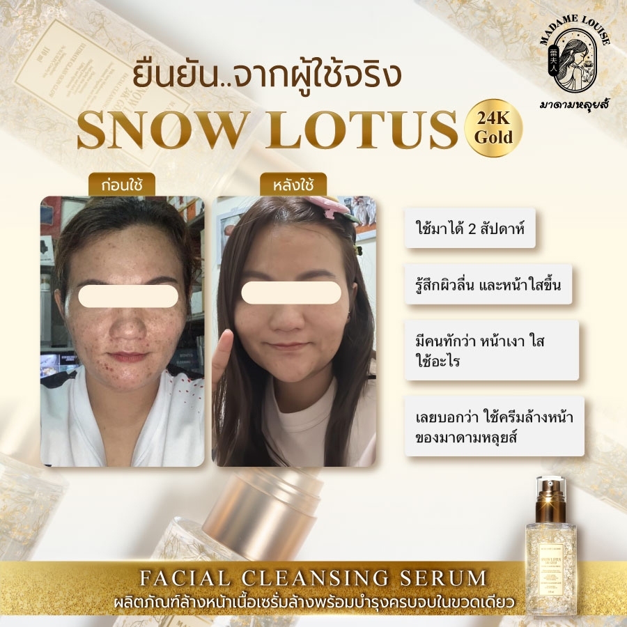 Madame Louise طقم Snow Lotus: كريم + سيروم منظف — صورة 4