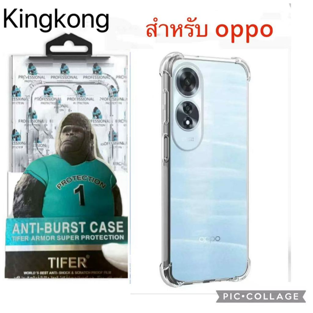 เคสใสแข็ง คิงคอง สำหรับ OPPO A12 A15 A15S A16 A16K A17 A17K A18 A38 A3 A3X A3pro เคสใสกันกระแทก
