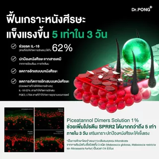 Dr.PONG 14D CalmScalp and Hair Repair Serum สเปรย์เซรั่มลดอักเสบแห้งแดงคัน รังแค เซ็บเดิร์ม ฟื้นเกราะหนังศีรษะ