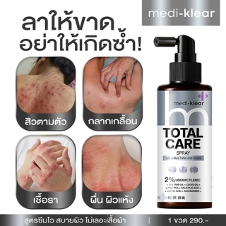 [ร้านยา] medi klear สเปรย์แก้คัน สิวที่หลัง สิวที่หลังและหน้าอก สิวที่ก้น ผดผื่น กากเกลื้อนเชื่อรา แก้คัน ลดสิว