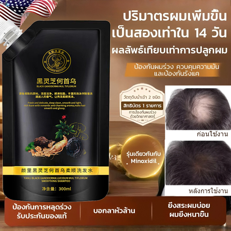 อัพเกรดไแชมพูป้องกันผมร่วงโสมและโชวู สมุนไพรสด7ชนิด ลดผมขาดหลุดร่วง ถนอมเส้นผม บำรุงผม กระตุ้นการงอกใหม่ Hair แชมพูบำรุง