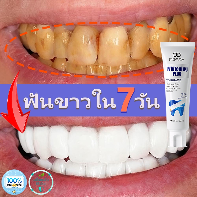 ยาสีฟันไวท์เทนนิ่ง LYDIMOON: ฟันขาว ลดคราบหินปูน ลดกลิ่นปาก ลดอาการฟันเหลืองจากการสูบบุหรี่ และป้องก