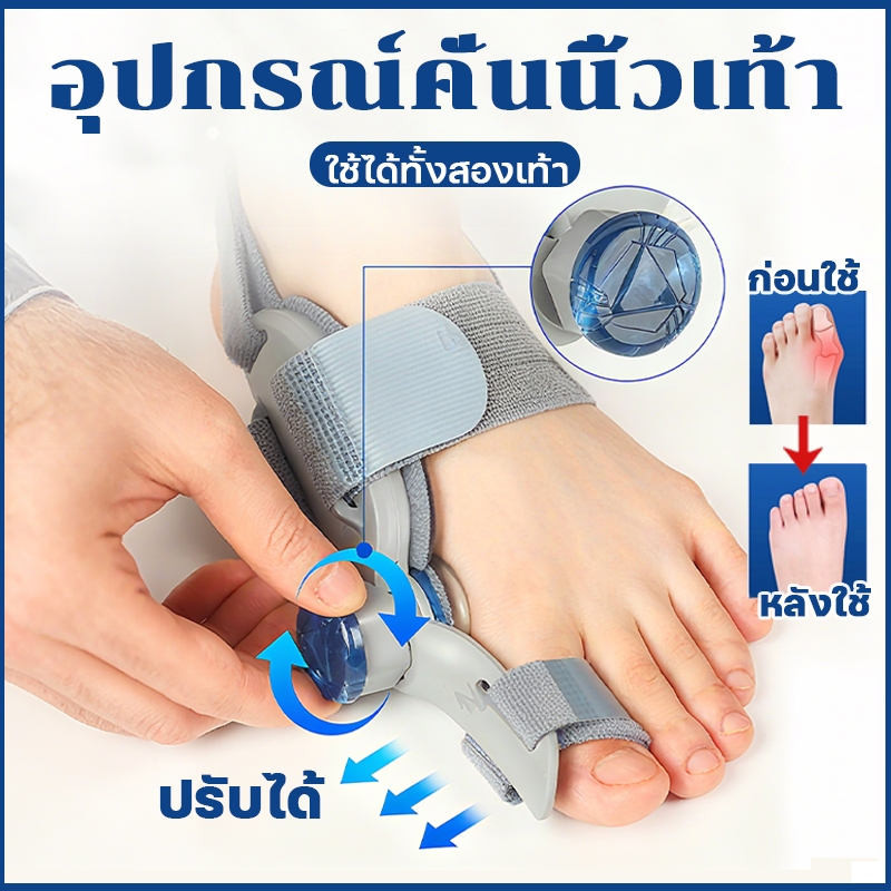 อุปกรณ์แก้ไขเท้า อุปกรณ์แยกนิ้วเท้า อุปกรณ์คั่นนิ้วเท้า ปรับความแน่น ช่วยให้นิ้วเท้าไม่เจ็บปวด