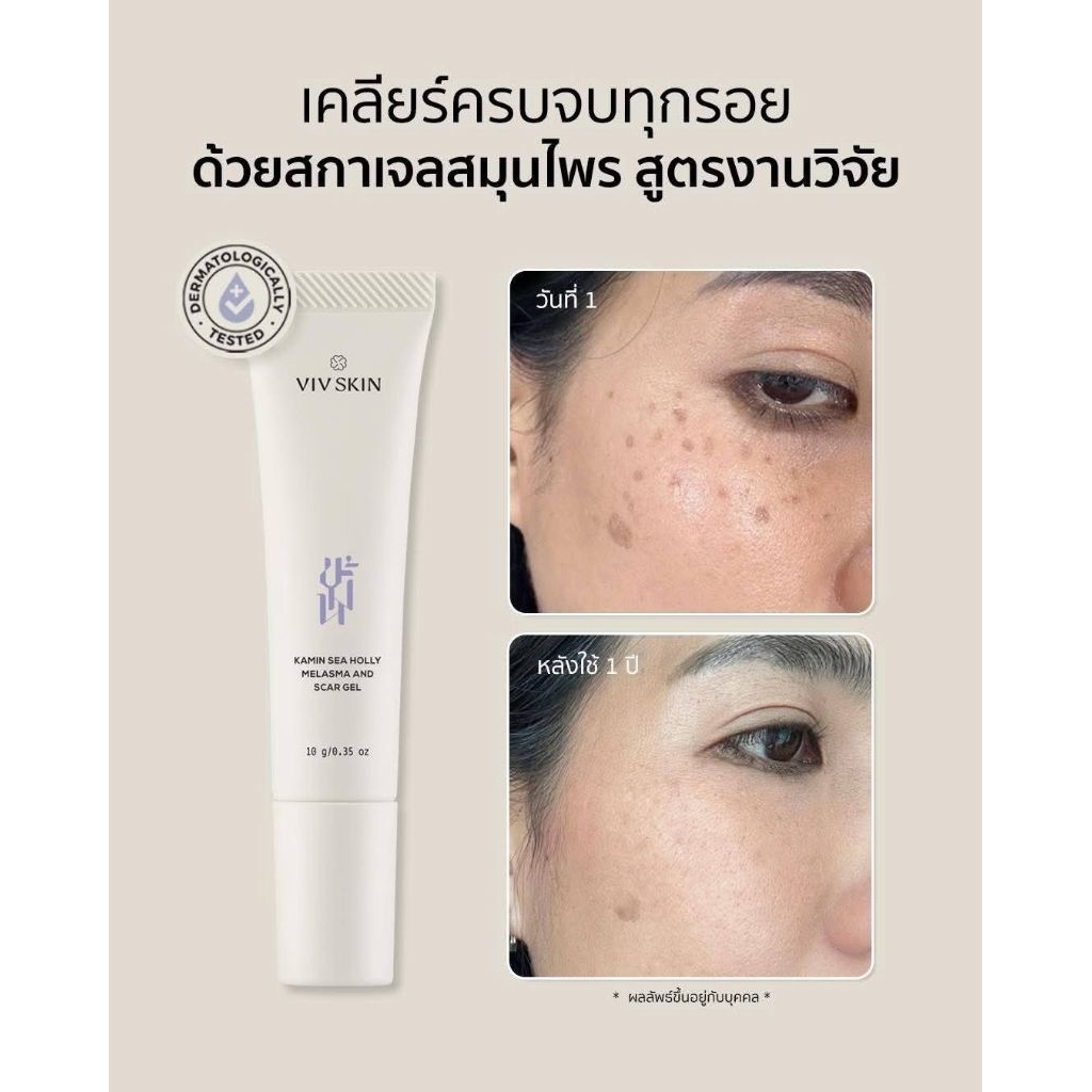 วิฟสกินขมิ้นซีฮอลลีเมลาสม่าสกาเจล