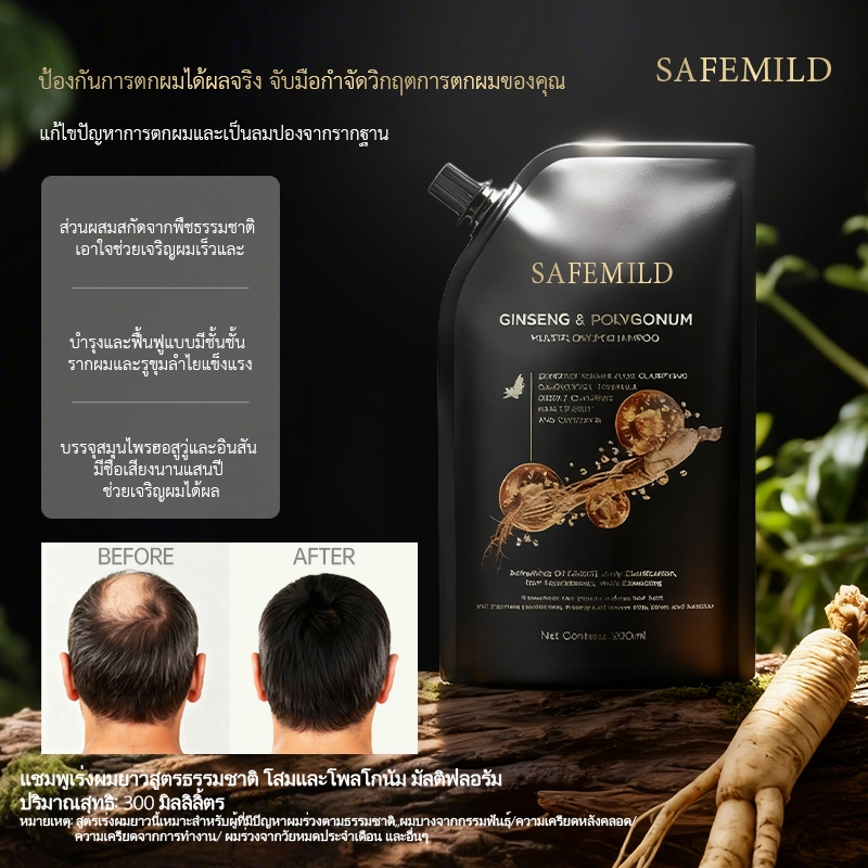 SAFEMILD Hair Growth Shampoo สเปรย์/แชมพูป้องกันผมร่วง บรรเทาคันหนังศีรษะ ลดผมบาง (Y928) สูตรสมุนไพรโบราณ