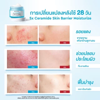 SKINTIFIC 5X Ceramide Barrier Moisturizer Gel บาล์มฟื้นบำรุงผิว ช่วยปลอบประโลม ฟื้นบำรุงผิว 30ml มอยส์เจอร์ไรเซอร์เจล