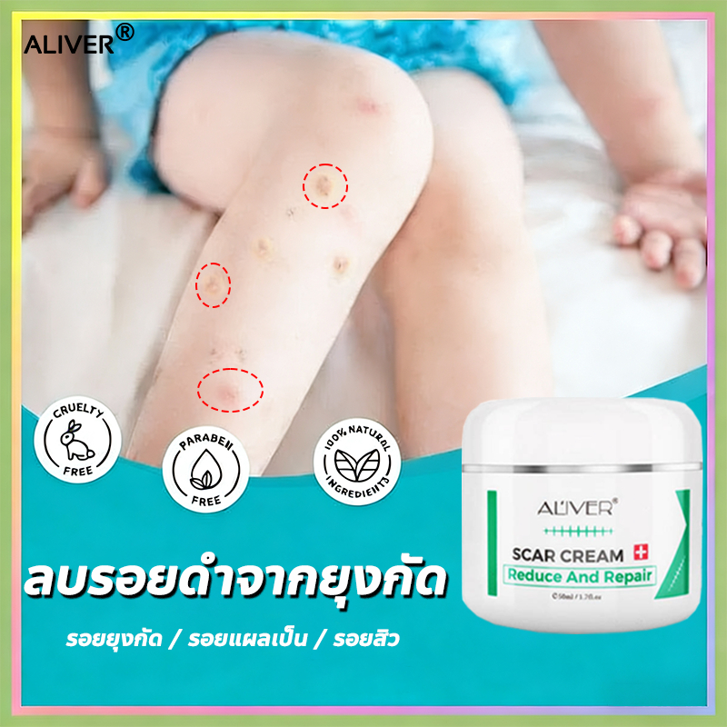 💯ของแท้🥰ALIVER ครีมกำจัดรอยแผลเป็น เจลลดรอยแผลเป็น ครีมกำจัดรอยแผลเป็น แผลเป็น แผลเป็นจากการผ่าตัด 50ml