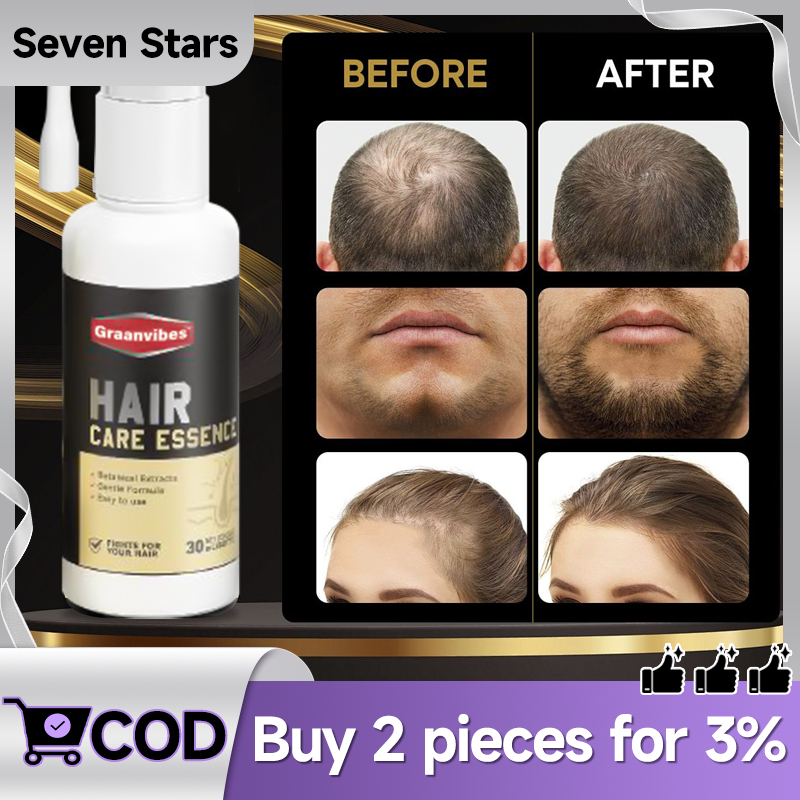 สเปรย์ คอนดิชันเนอร์ 30ml สเปรย์กระตุ้นการงอกของเส้นผม ช่วยลดการหลุดร่วงของผม กระตุ้นรากผม