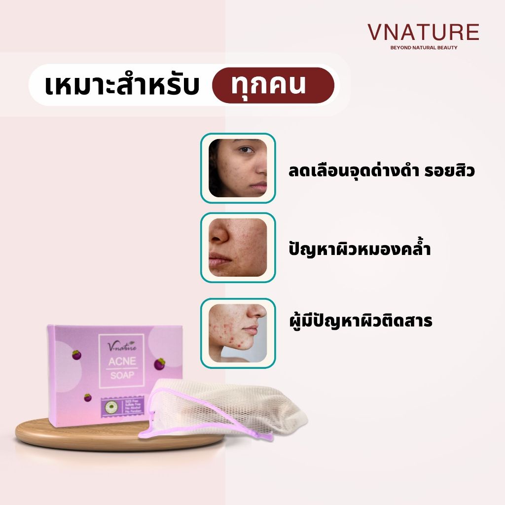 สบู่ลดสิว รอยสิว VNATURE Pimple&Whitening Soap สิวอุดตัน สิวอักเสบ ลดสิวผด สิวหลัง สบู่แก้สิว ผิวใส รูปที่ 3