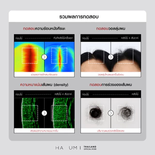 HAUM Anti-Hair Loss Scalp Therapy Shampoo แชมพูลดผมร่วงสูตรอ่อนโยนจากเกาหลี