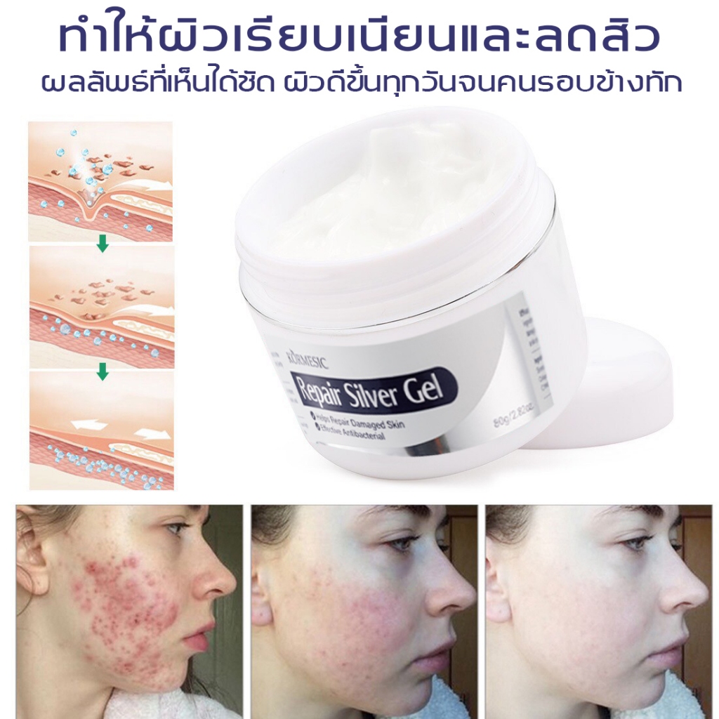 💯ครีมแผลเป็น ครีมลดรอยแผลเป็น 50g ครีมทาแผลเป็น ยาทาแผลเป็น น้ำร้อนลวก แผลเป็นนูนหนา แผลเป็นถลอก เร่งการซ่อมแซมให้ผิว - รูปที่ 3