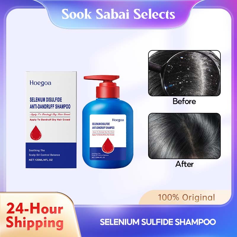 Hoegoa Selenium Sulfide Shampoo 120ml, Soothes Itchy Scalp & Controls Dandruff, Volumizing & Smooth
