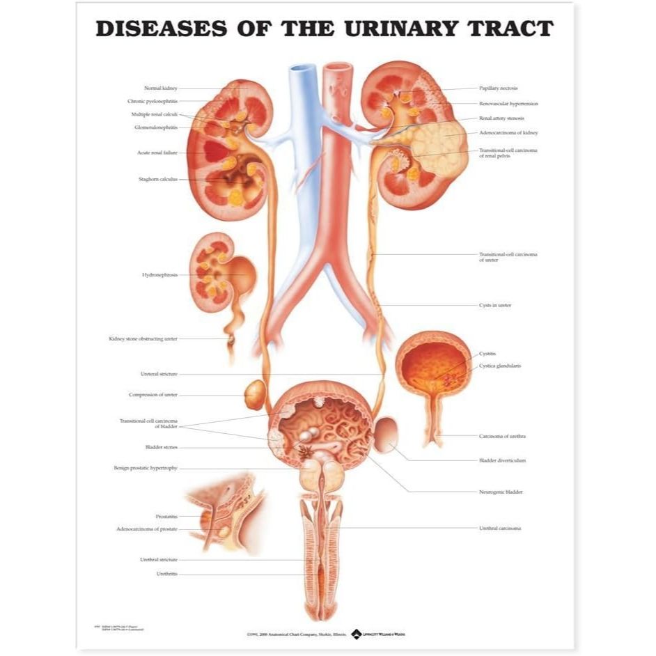 แผ่นโปสเตอร์ Diseases of the Urinary Tract Anatomical Chart (Paper) ed 1/2000