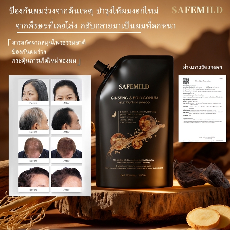 【สินค้าแท้100% 】SAFEMILD เซรั่มผมดํา เซรั่มบํารุงผมดํา ผมหงอก กลับมาดํา แชมพูสระผมดําหนา จากผมหงอกถึงผมดํา ลดผมร่วง