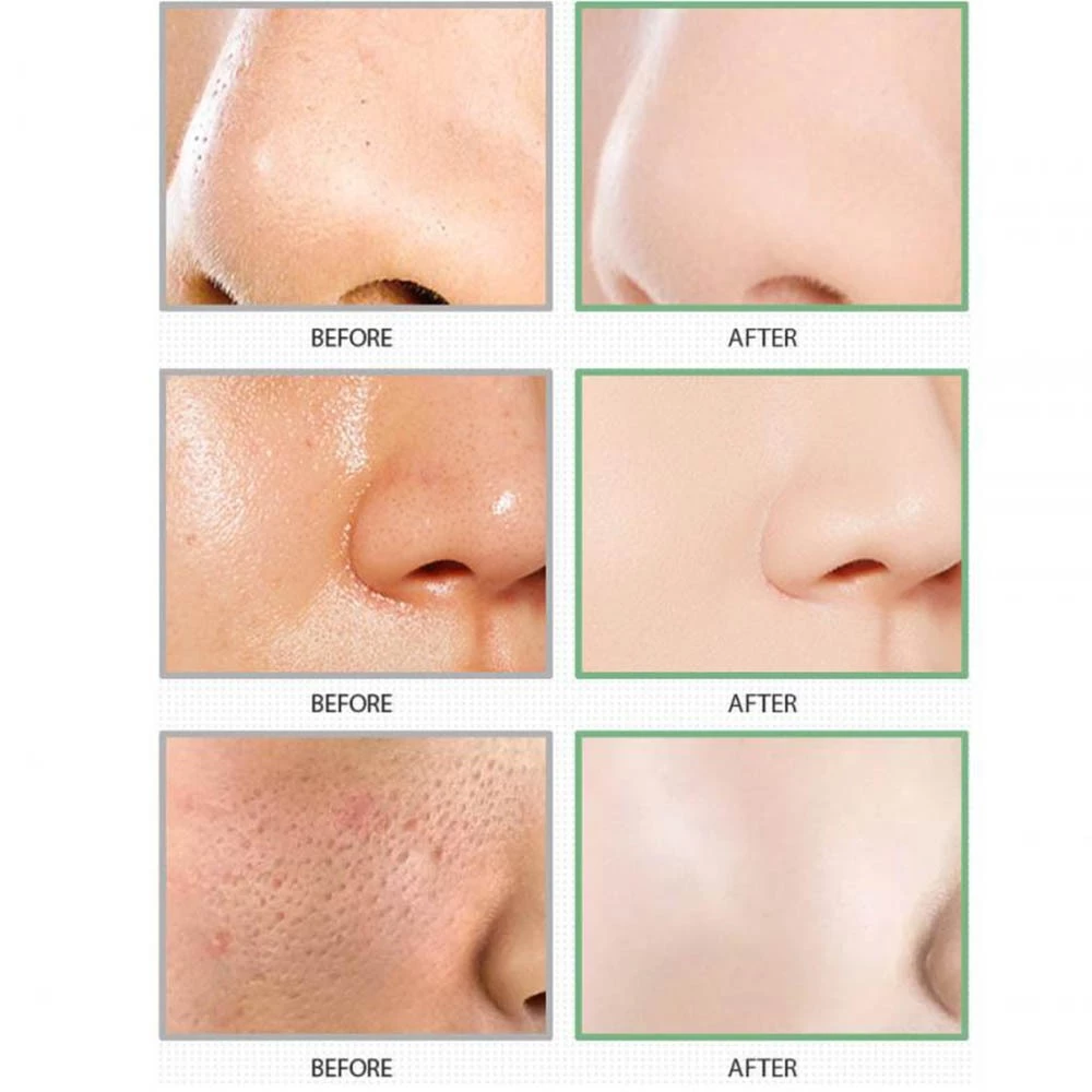 Mask Stick สกินทิฟิค มาสก์โคลนแบบแท่ง มาร์กโคลน มาร์คหน้า มาร์ค มาส์กโคลน บำรุงผิวหน้า สกินแคร์ อลาสก้า โวลคาโน ดีพ พอร์ thumbnail 5