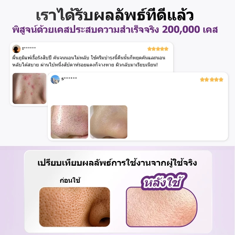 Kreain Nature เจลดูแลผิว Skin Soothing Cream thumbnail 4