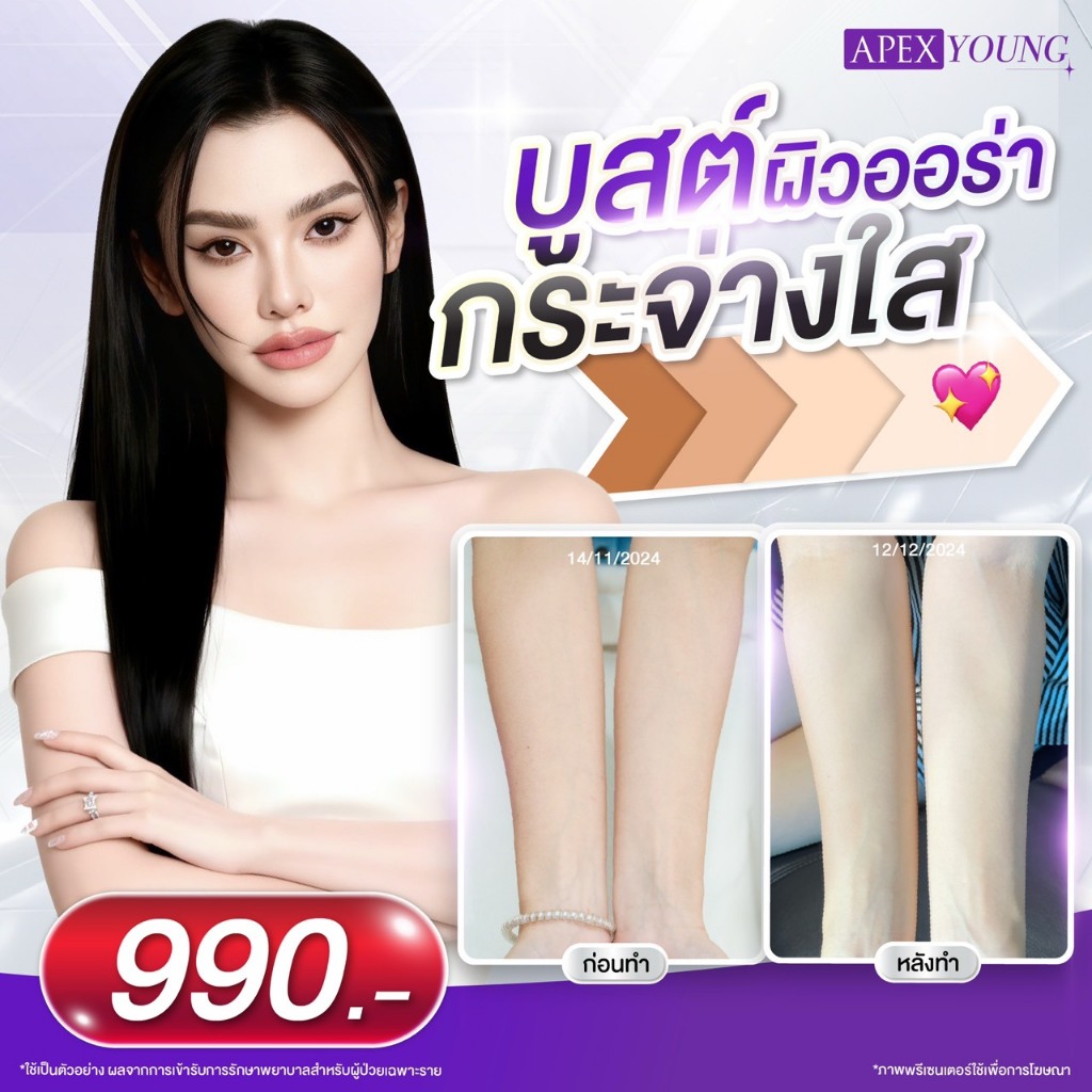 [E-Voucher] APEX วิตามินผิวใส Aura Booster บูสต์ผิวกระจ่างใส นุ่มลื่น ติดสปีด ผิวขาว ราคาพิเศษ 990.-