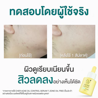 CHER Acne Oil Control T-zone (Oil Free) เฌอ เซรั่มไฮยาลดสิว 20mL