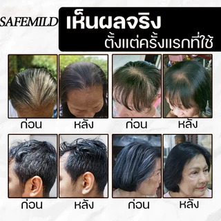 [สุดคุ้ม 1+1] SAFEMILD ช่วยดูแลและทำความสะอาดเส้นผม บำรุงผมแห้งเสีย แชมพู + คอนดิชั่นเนอร์ 300+160มล