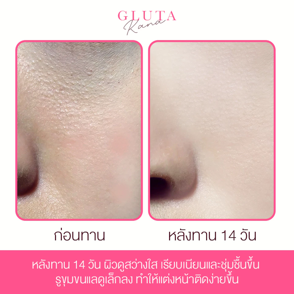 Gluta Kana กลูต้าบำรุงผิว 16 ชนิด thumbnail 9