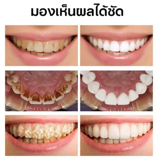 VIVX ยาสีฟัน ยาสีฟันฟันขาว ฟอกฟันขาว 120g ยาสีฟันขจัดปูน ขจัดคราบเหลือง ยาสีฟันขจัดหิน ลดกลิ่นปาก teeth whitening