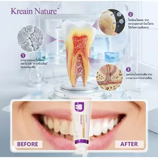 (ซื้อ 1 แถม 1 )Kreain Natureยาสีฟันสำหรับดูแลช่องปากมืออาชีพ บรรเทาอักเสบเหงือก เหงือกยุบย่